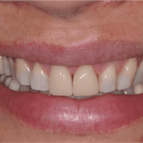 after treatment at Columbia Family Dentistry