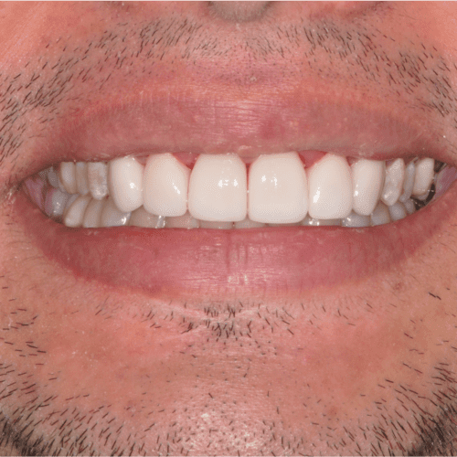 after treatment at Columbia Family Dentistry