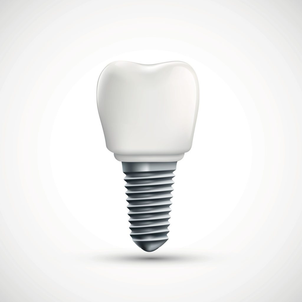 Single Dental Implants