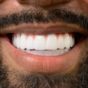 After restorative dental care at Columbia Family Dentist