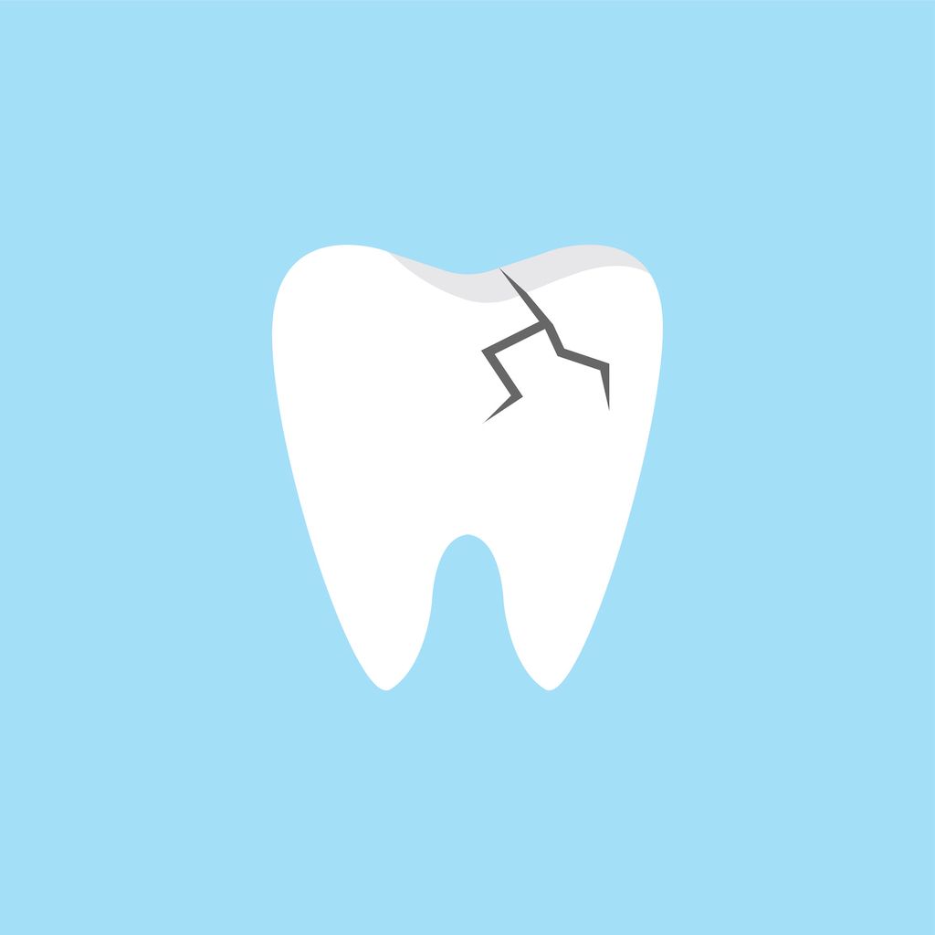 How to Treat a Broken Tooth